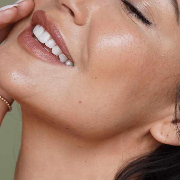 SkinPen Face | Aesteem Aesthetics | Botox | Dysport | Wrinkle Reduction